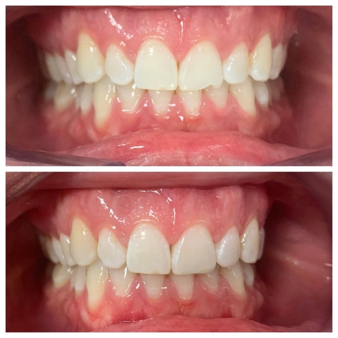 Before & After Treatment Photo
